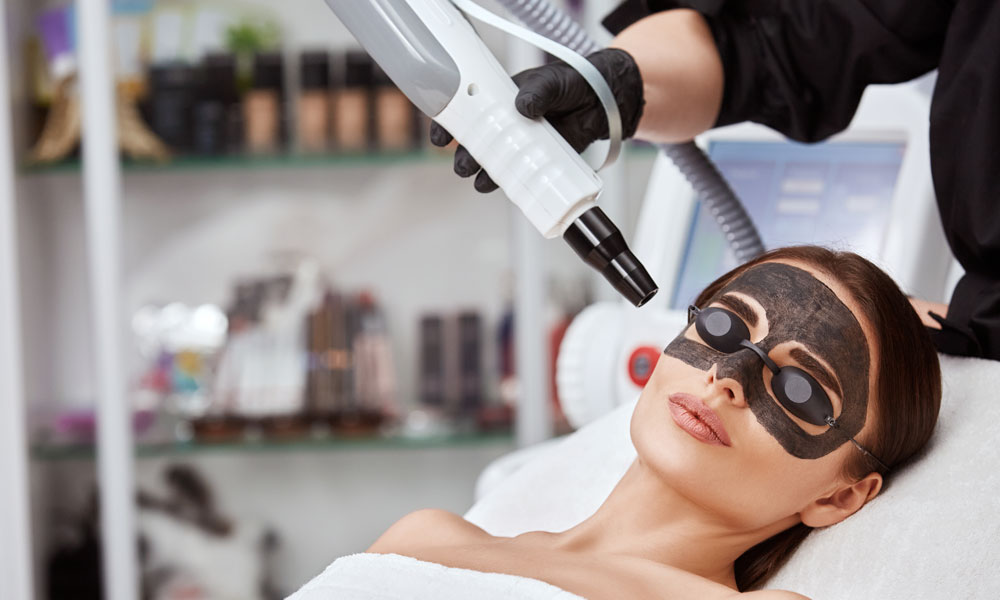 Carbon Facial ND:YAG